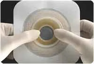 Natura® Stomahesive® Skin Barrier, Tan, Moldable Stoma Opening 1/2" - 7/8" (13mm - 22mm), Flange 2-1/4" (57mm) - Box of 10